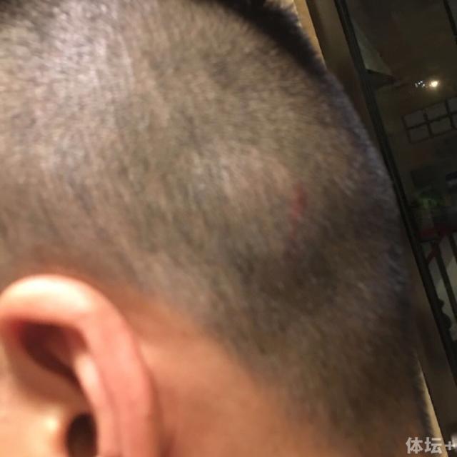 1473653078706051803.jpg 62713481gw1f7q3onfuwfj20qo0qoju9.jpg
