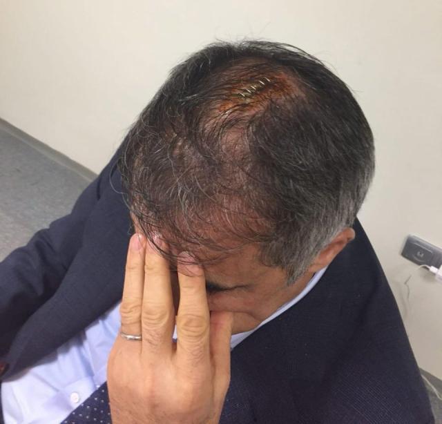 土耳其德比战老帅被砸伤头部缝5针 比赛中止
