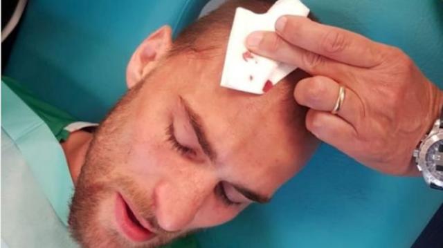 里斯本竞技教练球员挨打 决赛不打了?集体解约